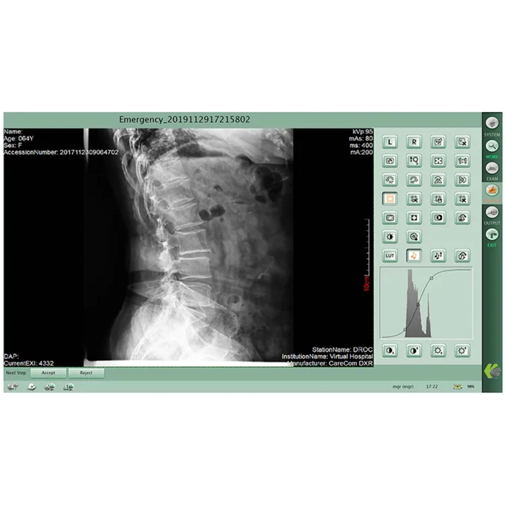 Flat Panel inalámbrico de radiografía digital CareRay 1500Cwe 14x17