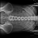 Flat Panel inalámbrico de radiografía digital CareRay 1500Cwe 14x17