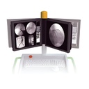 Arco en C Digital de Alta Frecuencia mod. SLA-70 para Ortopedia y Angiografia Venosa
