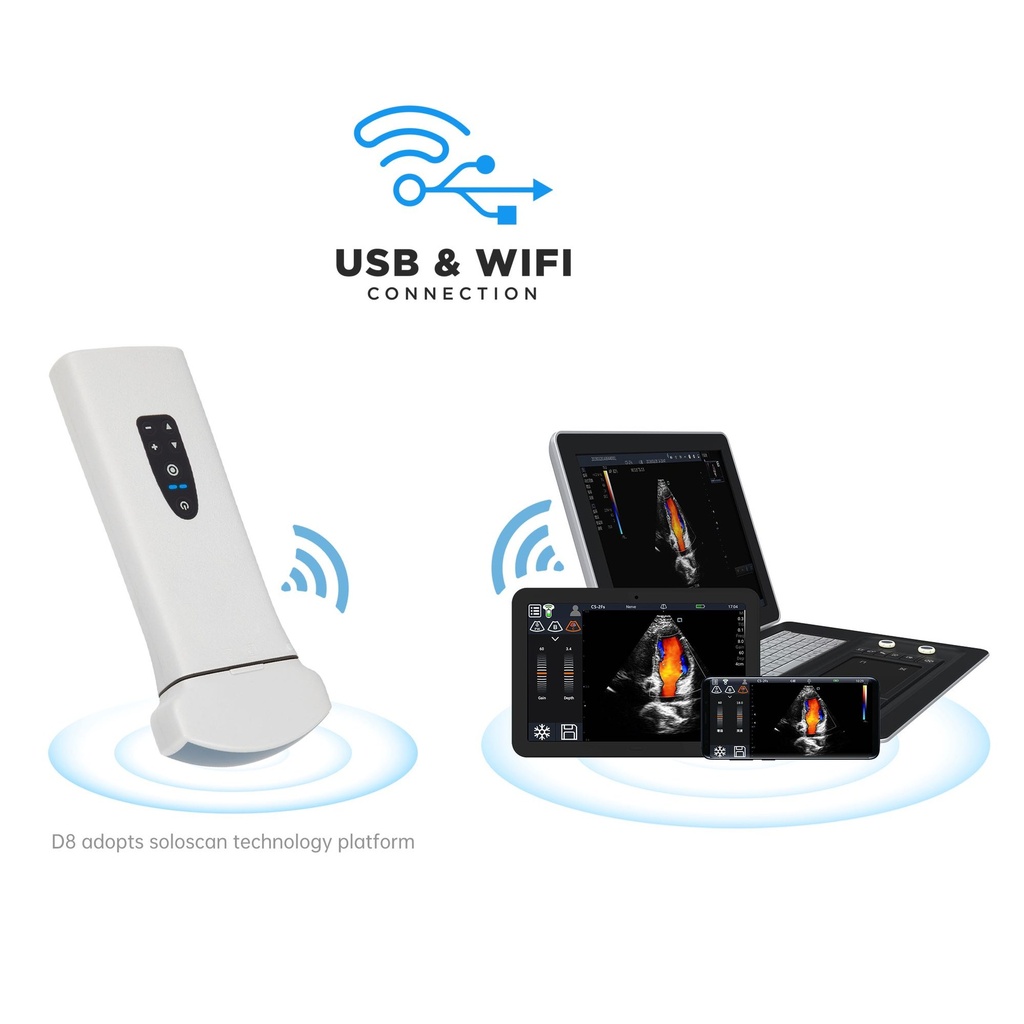 Ultrasonido ultraportatil wifi o USB Mod. D8