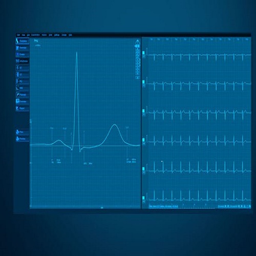 Licencia CardioPoint C600, Software avanzado para conectar a PC para el electrocardiografos BTL