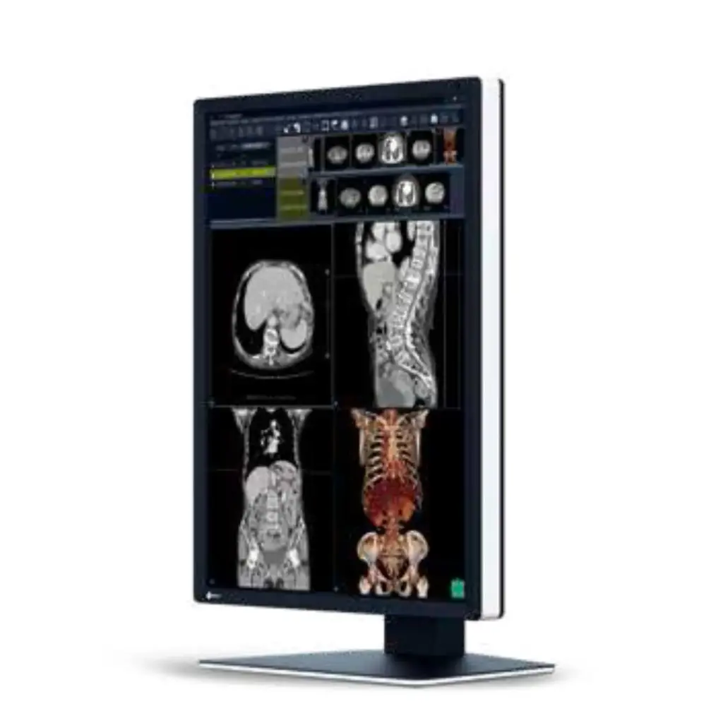 Monitor sencillo grado medico de DIAGNOSTICO RadiForce 2MP 21.3" Color, 1200x1600