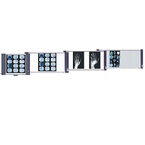 Negatoscopio sencillo LED Ultradelgado 6,500 Lux  10,000° K