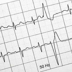 Papel para ECG en Z de 10 x 15cm 180 hojas caja con 10 paquetes