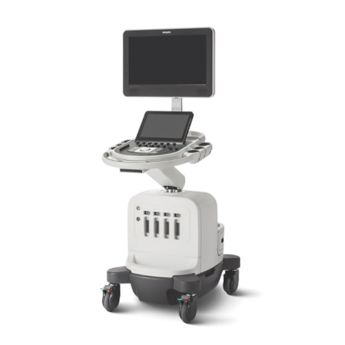 Ultrasonido Affinity 30 con transductor convexo e intracavitario vaginal
