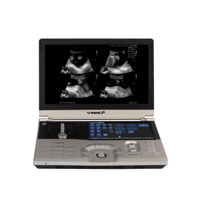 Ultrasonido portatil 15" color VINNO 6 con Modulos ECG y CW