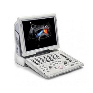 Ultrasonido portátil doppler color Mod. Z6 pantalla 15" con 1 transductor lineal Mindray