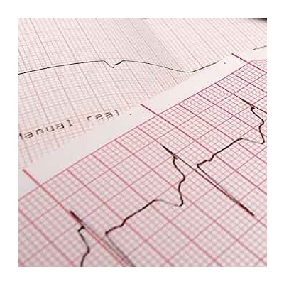 Papel para ECG en Z de 21 x 29.5cm paquete c/10 piezas