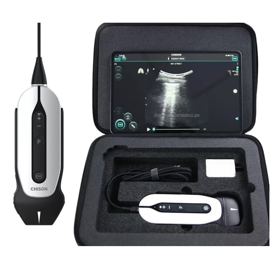 Ultrasonido de mano Sonoeye P1 Lineal