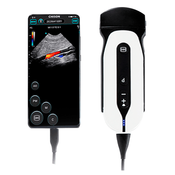 Ultrasonido de Mano mod. Sonoeye P5 Convexo