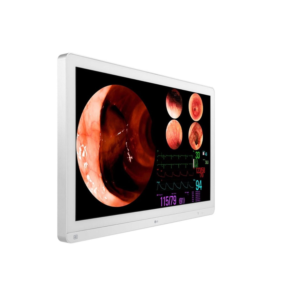 Monitor de 32" grado medico UHD 4K LG Mod. 32HL710S 