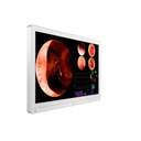 Monitor de 32" grado medico UHD 4K LG Mod. 32HL710S 