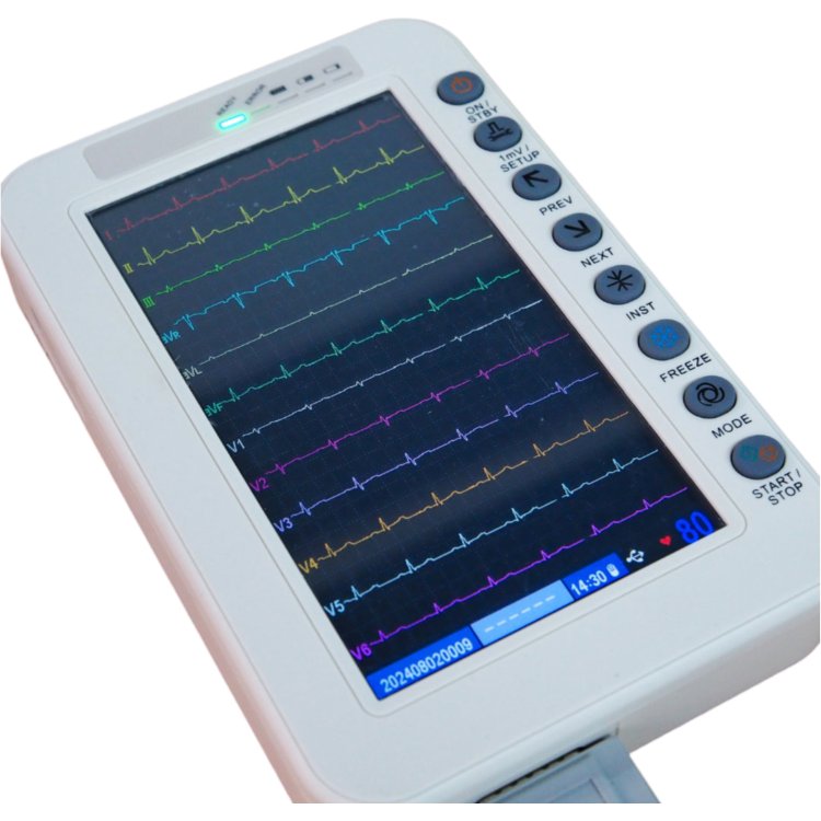 ECG Portatil de 12 Canales mod. YuumECG Pantalla Tactil de 7"