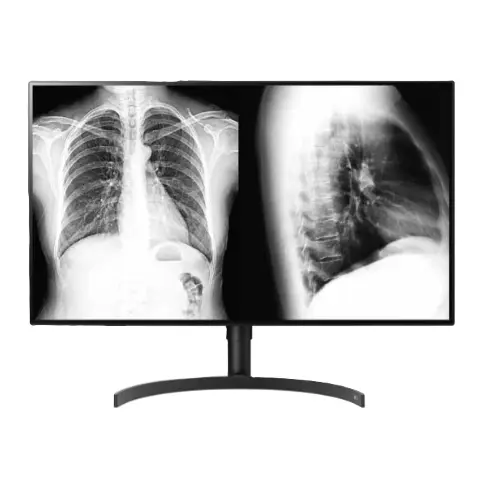 Monitor de diagnostico grado medico de 31.5" 8MP