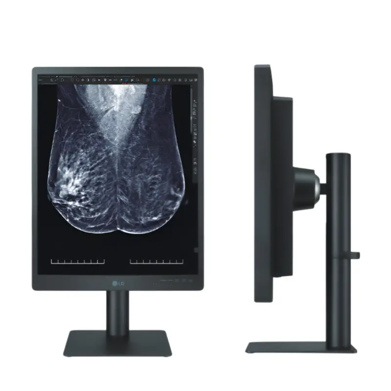Monitor de Diagnostico Grado Medico de 21.3" 5MP