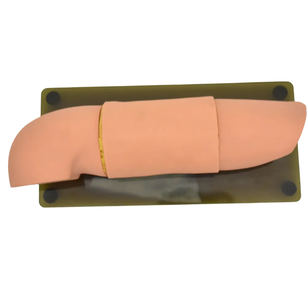 Brazo para colocación y remoción de material anticonceptivo 