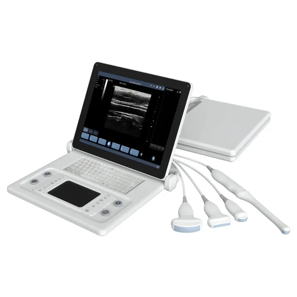 Ultrasonido portatil F6 con un transductor