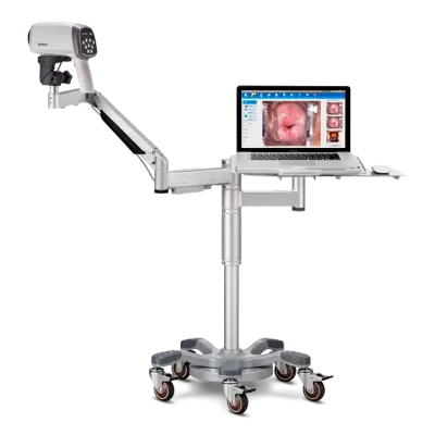 Videocolposcopio con soporte de brazo articulado y bandeja para PC