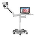Videocolposcopio con soporte de brazo articulado y bandeja para PC
