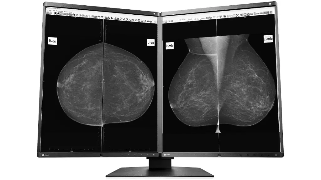 Monitor sencillo grado médico de diagnóstico Radiforce 5MP, de 21.3", Monocromático, 2048 x 2560.