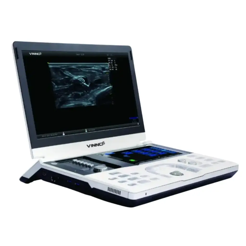 Ultrasonido Vinno 6