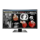 Monitor Sencillo de Revisión Clínica Radiforce 8MP, de 30.5", Color, 4096 x 2160 (4k)