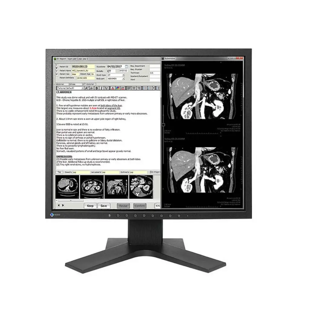 Monitor Sencillo de Revisión Clínica Radiforce 1.3MP, de 19", Color, 1280 x 1024