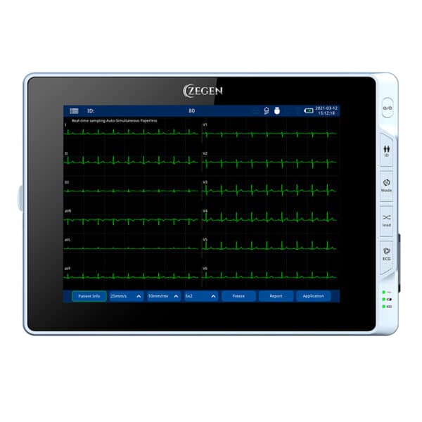 Electrocardiografo de 12 Canales Tipo Tablet mod. ZGN-60 Pantalla Tactil 9.7" 