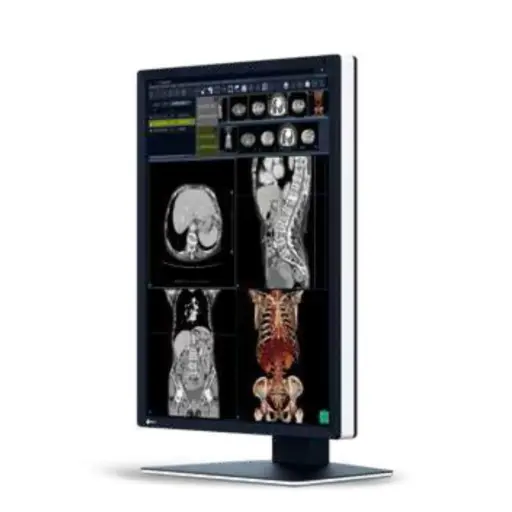 Monitor sencillo grado medico de DIAGNOSTICO RadiForce 2MP 21.3" Color, 1200x1600