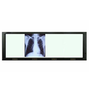 [BAM-320L] Negatoscopio cuadruple de pared con luz LED 10,000 luxes 9600°K