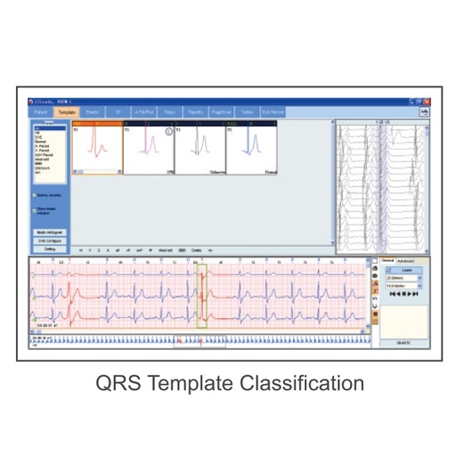 Programa Analizador CardioSW Holter para grabadoras CV3L, MC6800 y BI6800