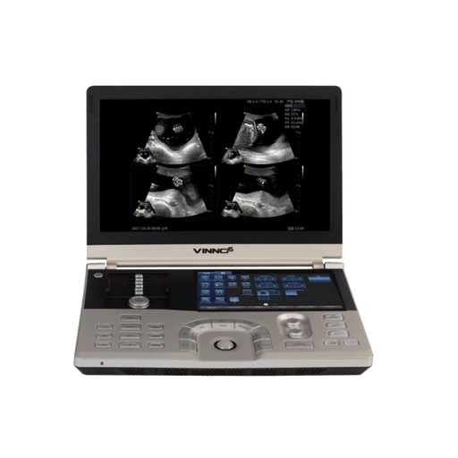 Ultrasonido portatil 15" color VINNO 6 con Modulos ECG y CW