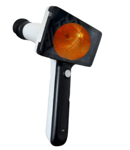 Camara retinal portatil Mod. CFC-S 