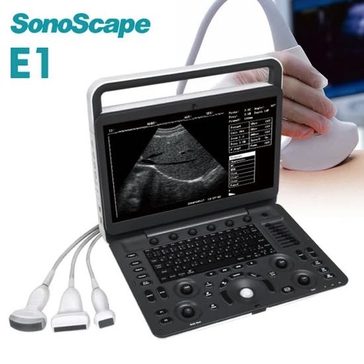 [SON-E1] Ultrasonido portatil Mod. E1 expert