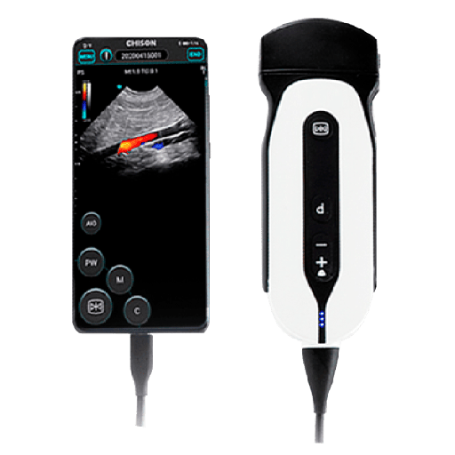 Ultrasonido de Mano mod. Sonoeye P5 Convexo