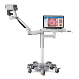 Videocolposcopio con soporte de brazo articulado y bandeja para PC