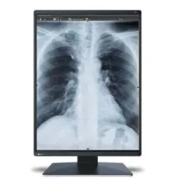 Monitor sencillo grado médico de diagnóstico Radiforce 3MP, de 21.3", color, 1536 x 2048.