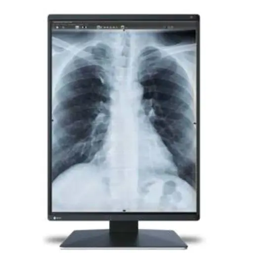 Monitor sencillo grado médico de diagnóstico Radiforce 3MP, de 21.3", color, 1536 x 2048.