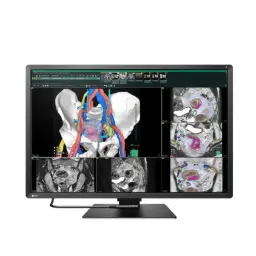 Monitor Sencillo Grado Médico De Diagnóstico Radiforce 6MP, de 30", Color, 3280 x 2048.