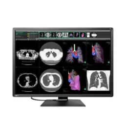 Monitor Sencillo Grado Médico De Diagnóstico Radiforce 12MP, de 30.9", Color, 4200 x 2800