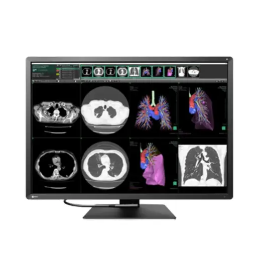 Monitor Sencillo Grado Médico De Diagnóstico Radiforce 12MP, de 30.9", Color, 4200 x 2800