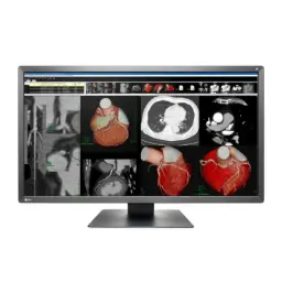 Monitor Sencillo de Revisión Clínica Radiforce 8MP, de 30.5", Color, 4096 x 2160 (4k)