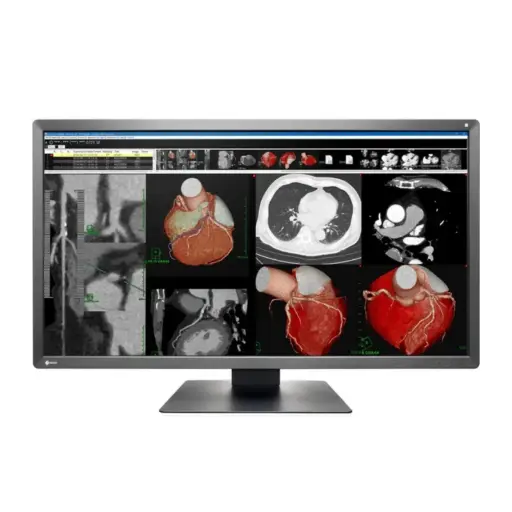 Monitor Sencillo de Revisión Clínica Radiforce 8MP, de 30.5", Color, 4096 x 2160 (4k)