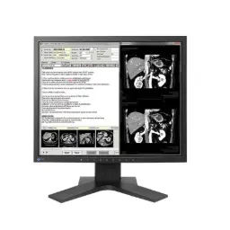 Monitor Sencillo de Revisión Clínica Radiforce 1.3MP, de 19", Color, 1280 x 1024