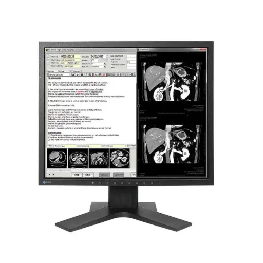 Monitor Sencillo de Revisión Clínica Radiforce 1.3MP, de 19", Color, 1280 x 1024