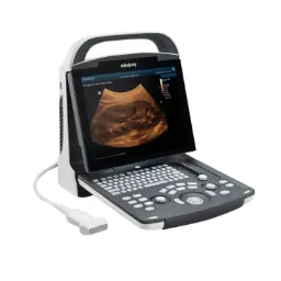 Ultrasonido portátil Mod. DP20 pantalla 12.1"