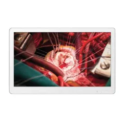 Monitor grado medicos LG1 FullHD 27" sin base